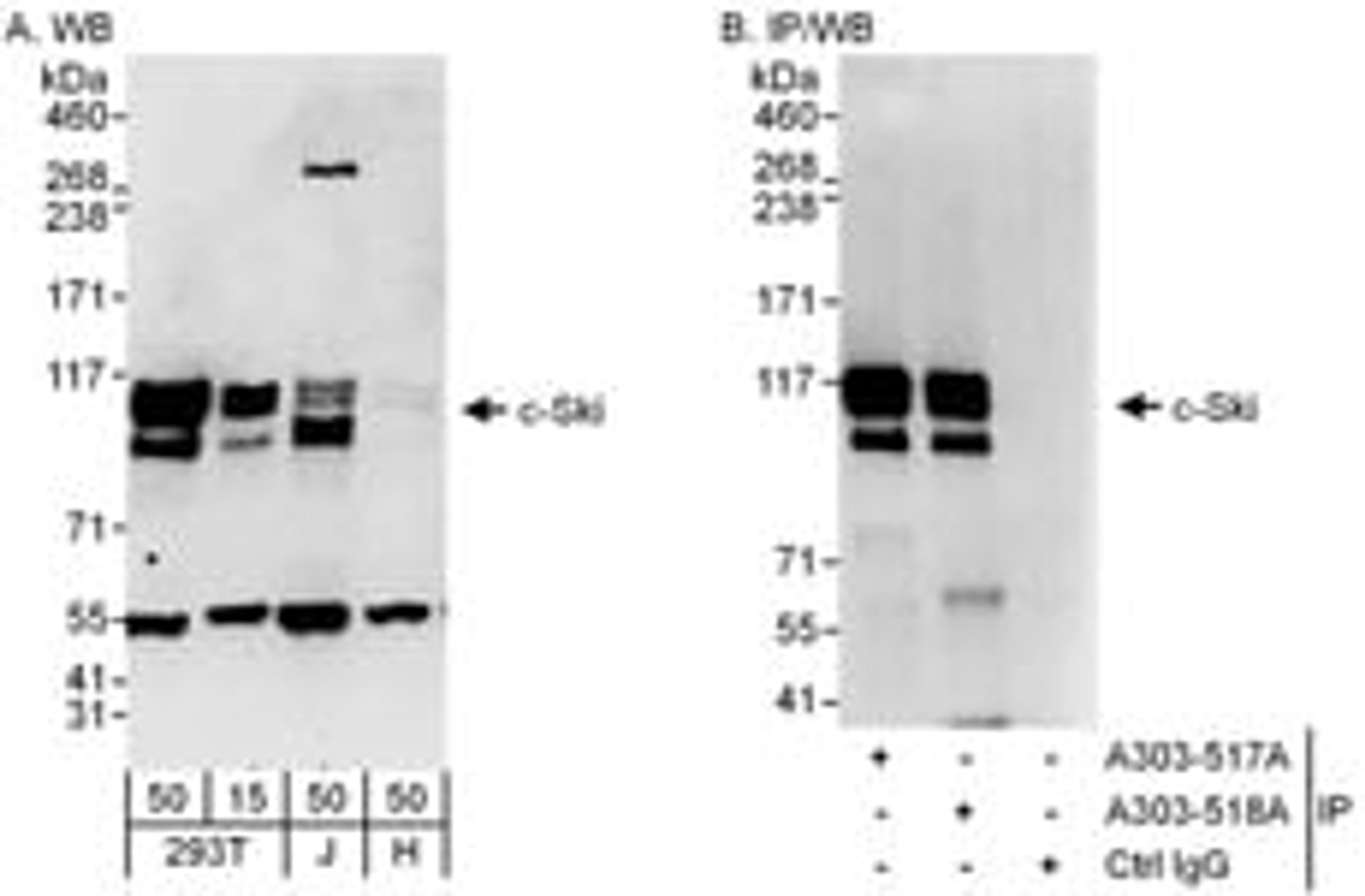 Detection of human c-Ski by western blot and immunoprecipitation.