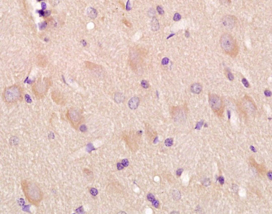 Immunohistochemical analysis of formalin-fixed and paraffin-embedded rat brain tissue using  kappa Opiate Receptor antibody (dilution at: 1:50-100)