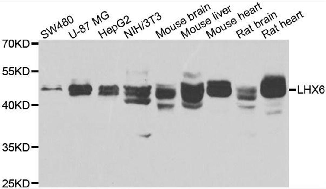 Western blot analysis of extracts of various cell lines using LHX6 antibody