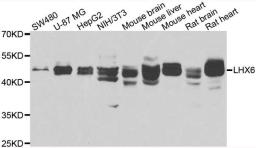 Western blot analysis of extracts of various cell lines using LHX6 antibody