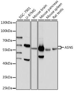 Western blot - ASNS antibody (A16035)