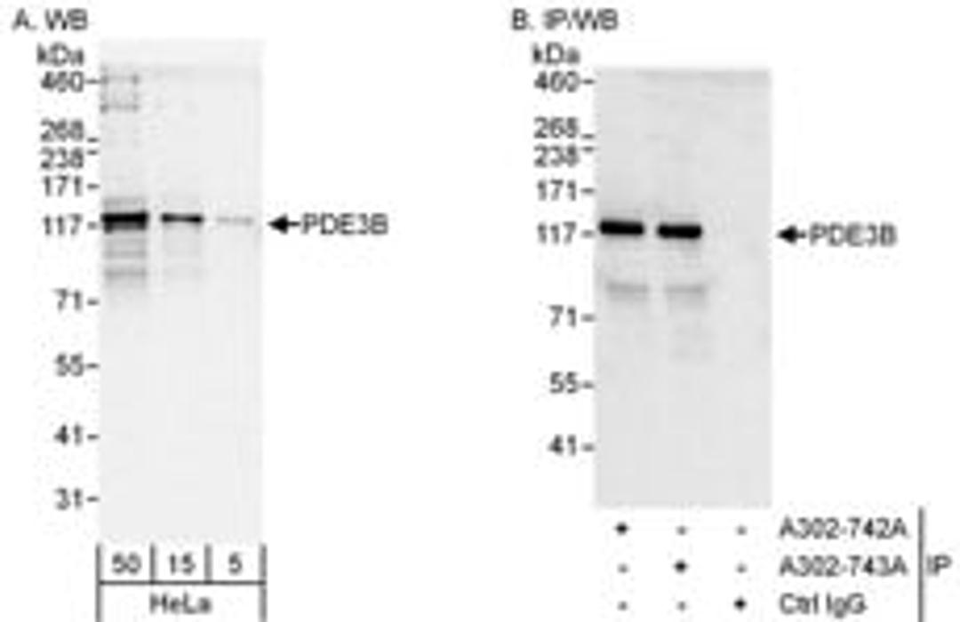 Detection of human PDE3B by western blot and immunoprecipitation.