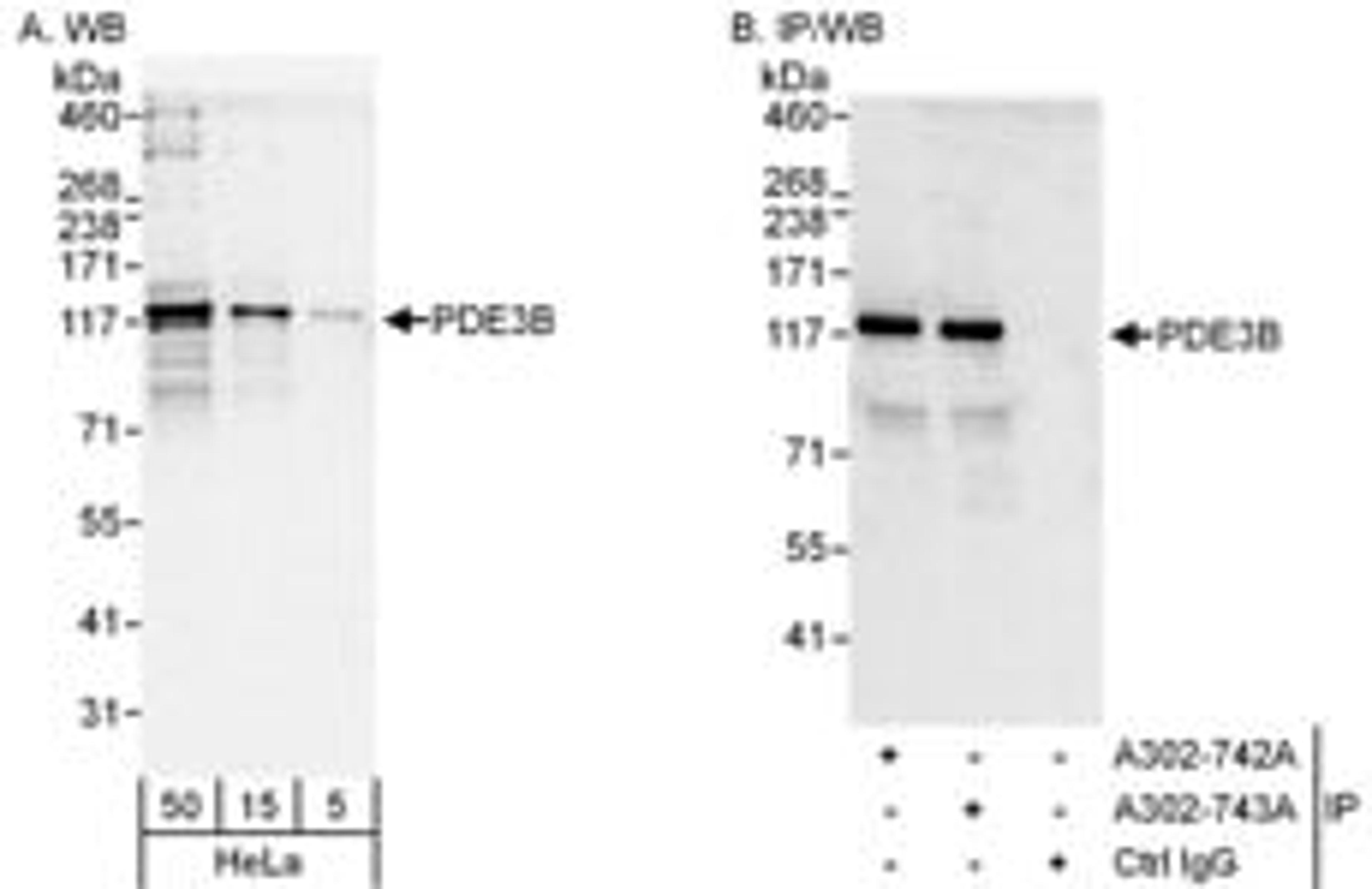 Detection of human PDE3B by western blot and immunoprecipitation.