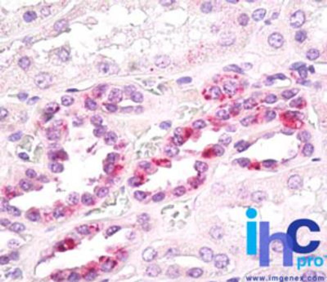 Immunohistochemistry-Paraffin: Slap Antibody [NBP2-24696] - Formalin-fixed, paraffin-embedded human kidney stained with SLAP antibody at 15 ug/ml. Staining of formalin-fixed tissues is enhanced by boiling tissue sections in 10 mM sodium citrate buffer, pH 6.0 for 10-20 min followed by cooling at RT for 20 min.