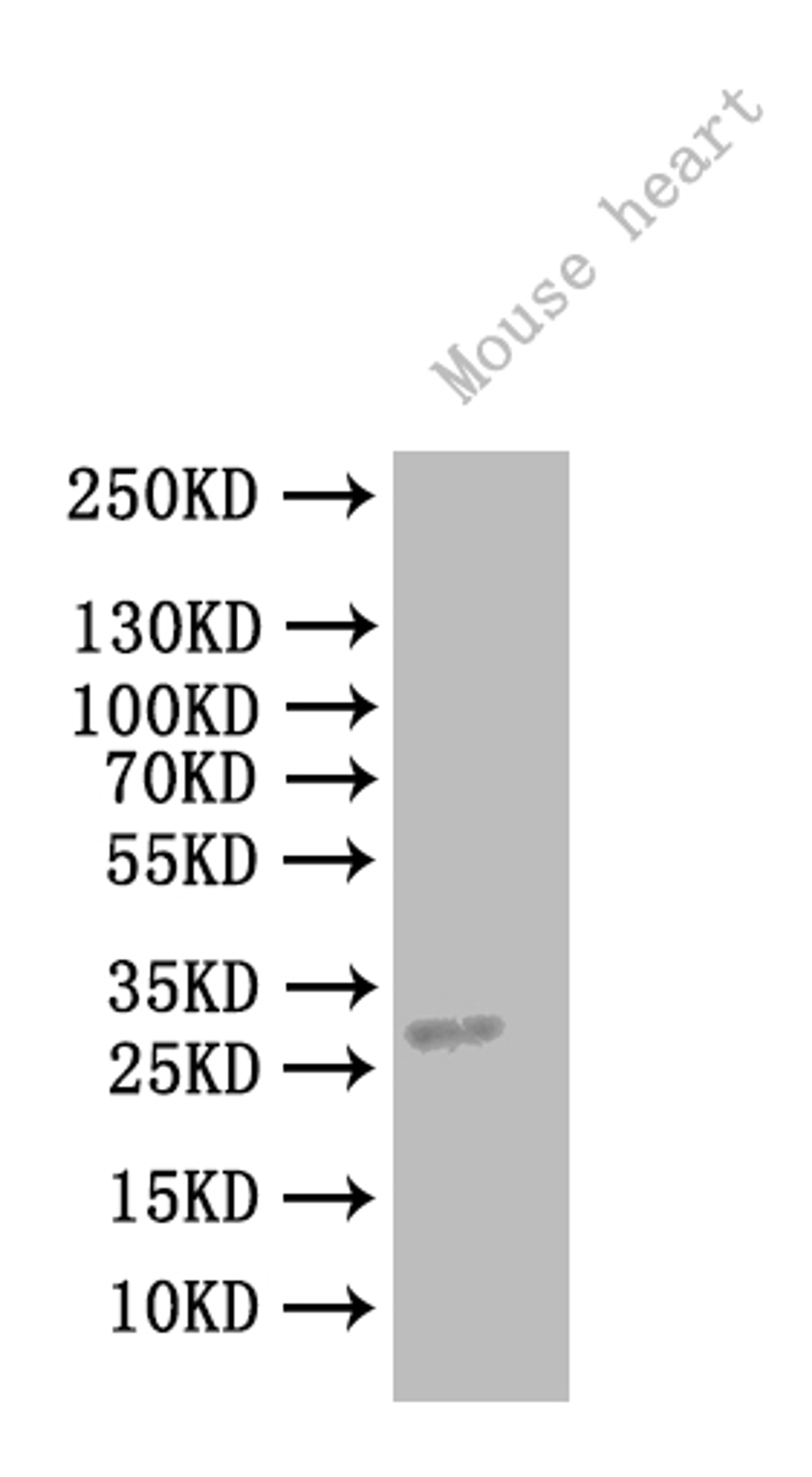 Western Blot. All lanes: CCDC103 antibody at 5µg/ml + Mouse heart tissue. Secondary. Goat polyclonal to rabbit IgG at 1/10000 dilution. Predicted band size: 28, 12 kDa. Observed band size: 111 kDa