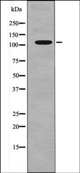 Western blot analysis of Insulin treated 293 whole cell lysates using FLT3 -Phospho-Tyr589- antibody