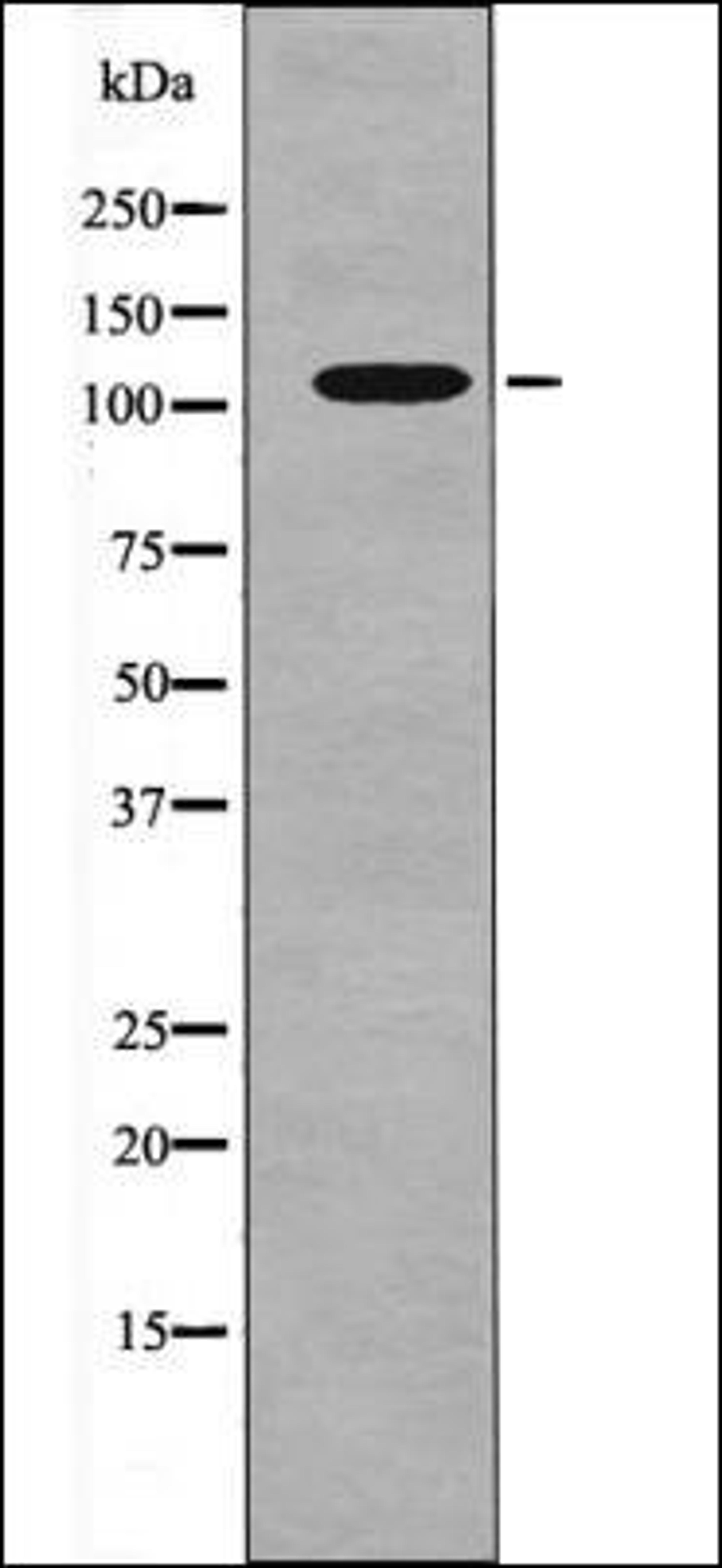 Western blot analysis of Insulin treated 293 whole cell lysates using FLT3 -Phospho-Tyr589- antibody