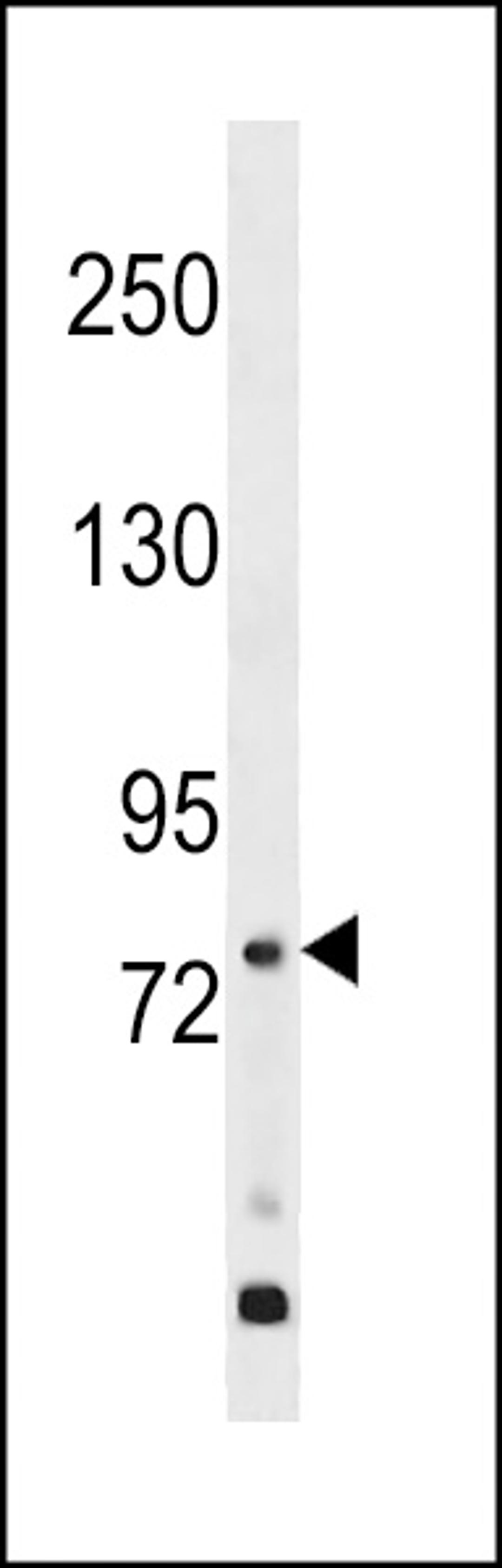 Western blot analysis in WiDr cell line lysates (35ug/lane).