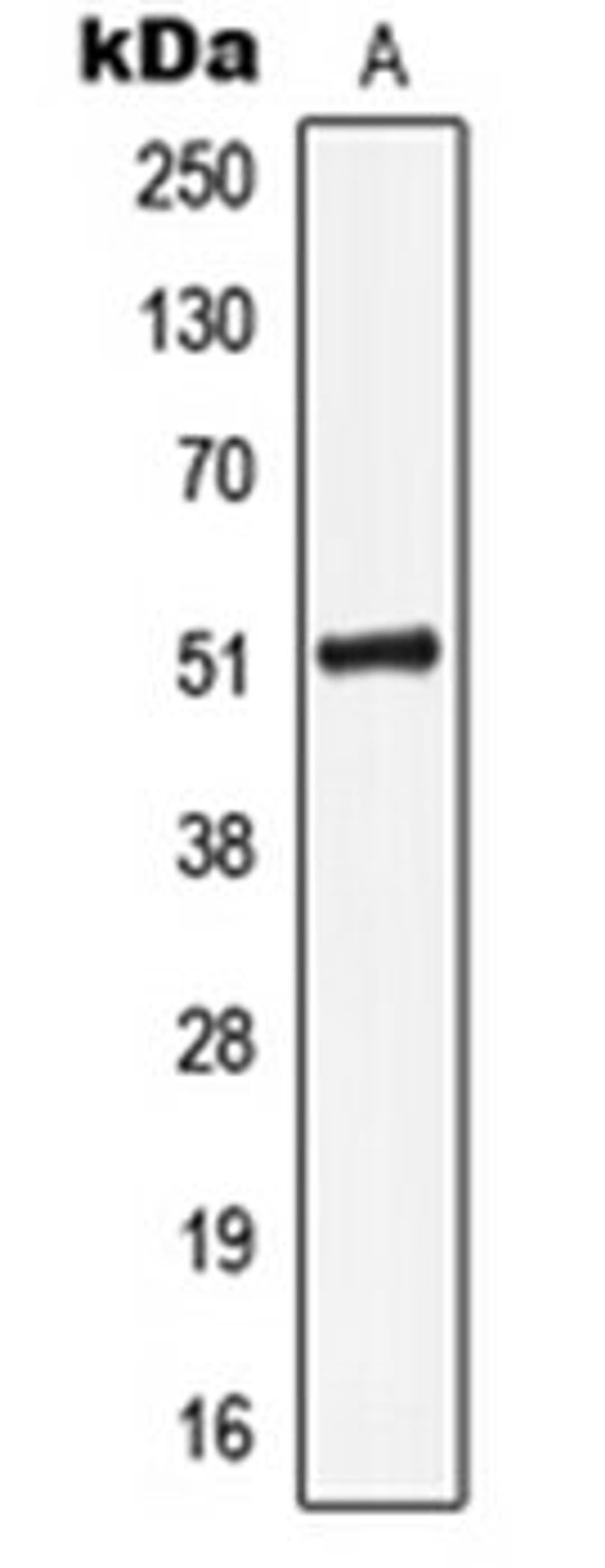 Western blot analysis of HeLa (Lane 1) whole cell lysates using KRT16 antibody