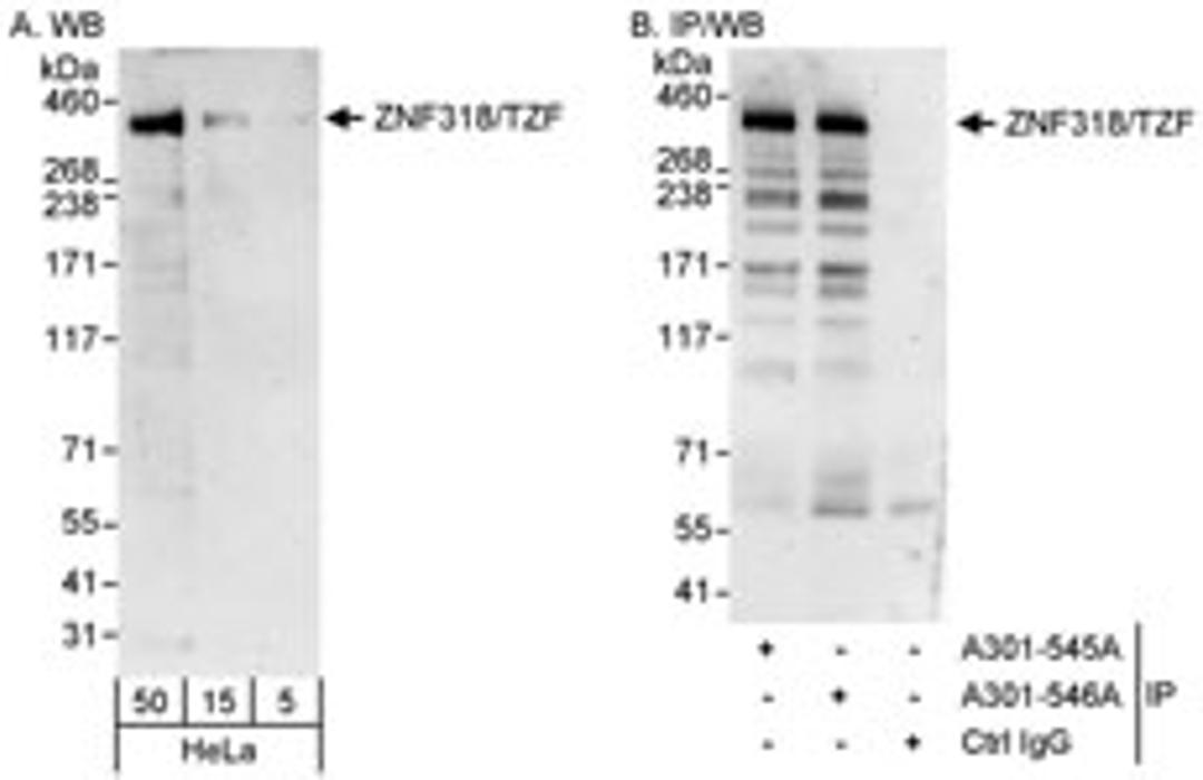 Detection of human ZNF318/TZF by western blot and immunoprecipitation.