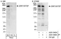 Detection of human ZNF318/TZF by western blot and immunoprecipitation.