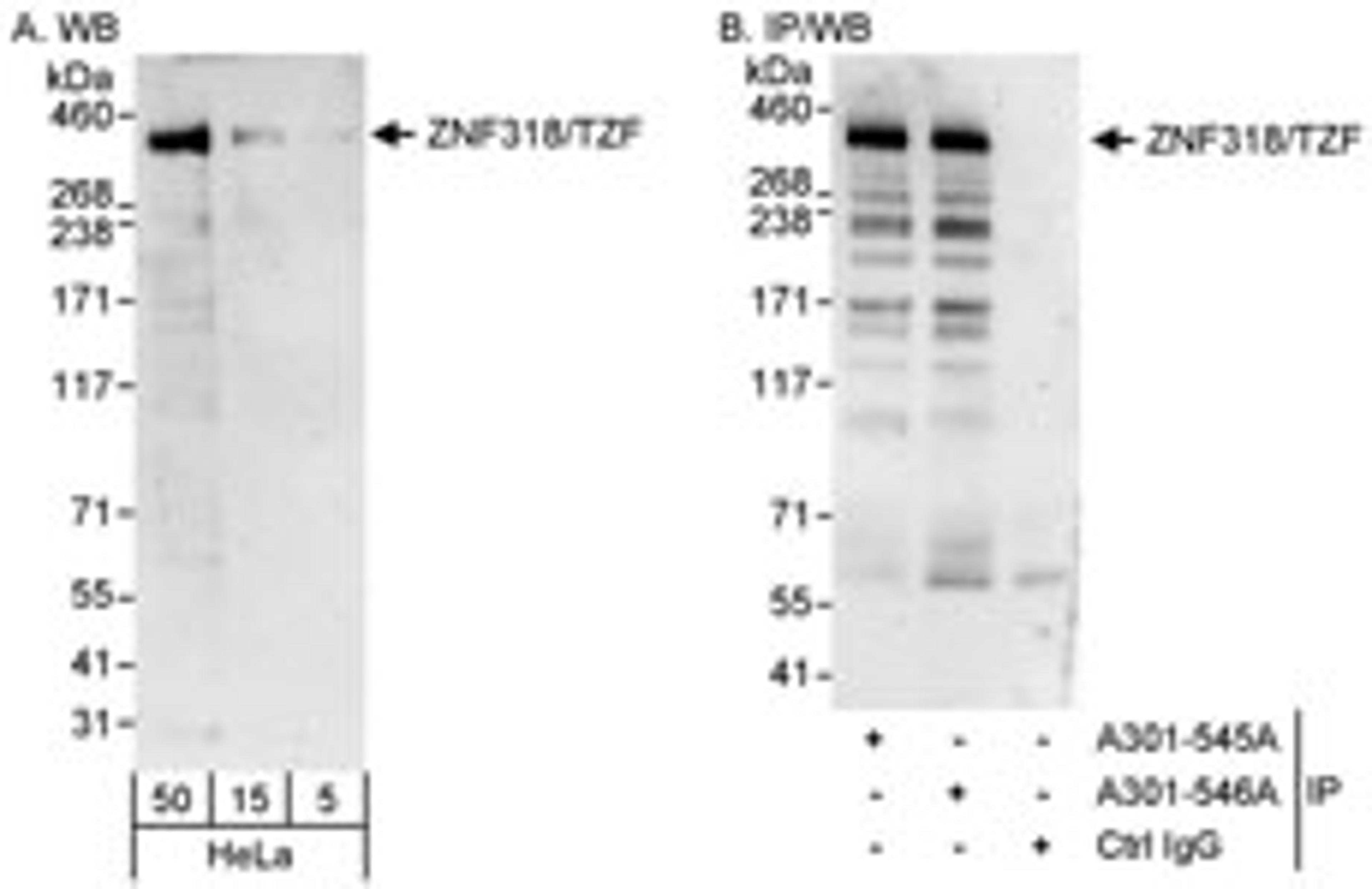 Detection of human ZNF318/TZF by western blot and immunoprecipitation.