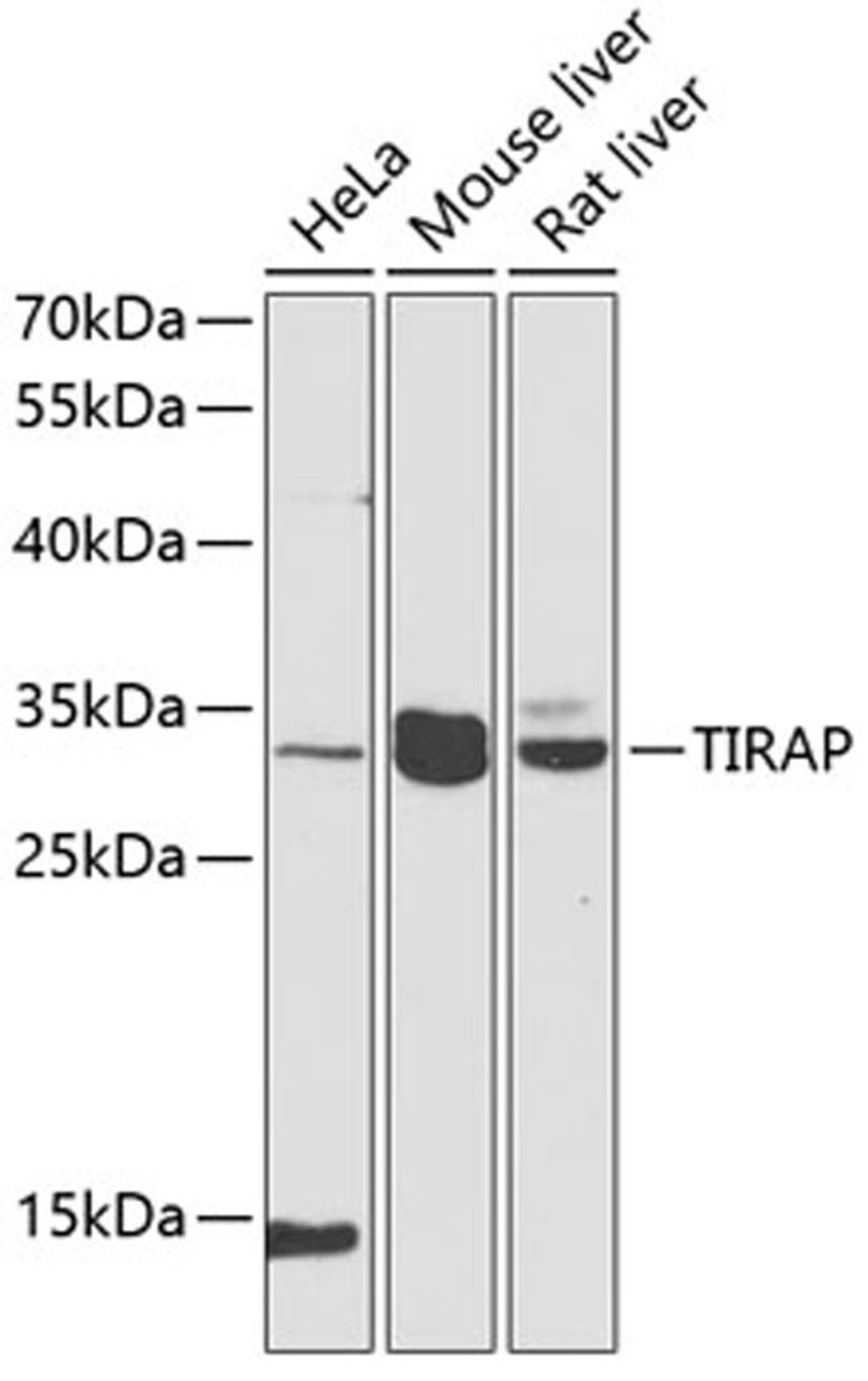 Western blot - TIRAP antibody (A12606)