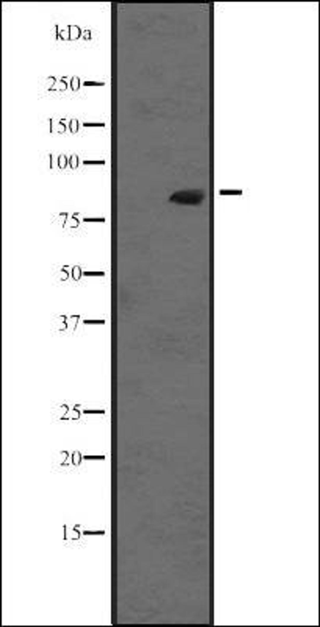 Western blot analysis of K-562 cell lysate at 25ug/lane. using RASEF antibody