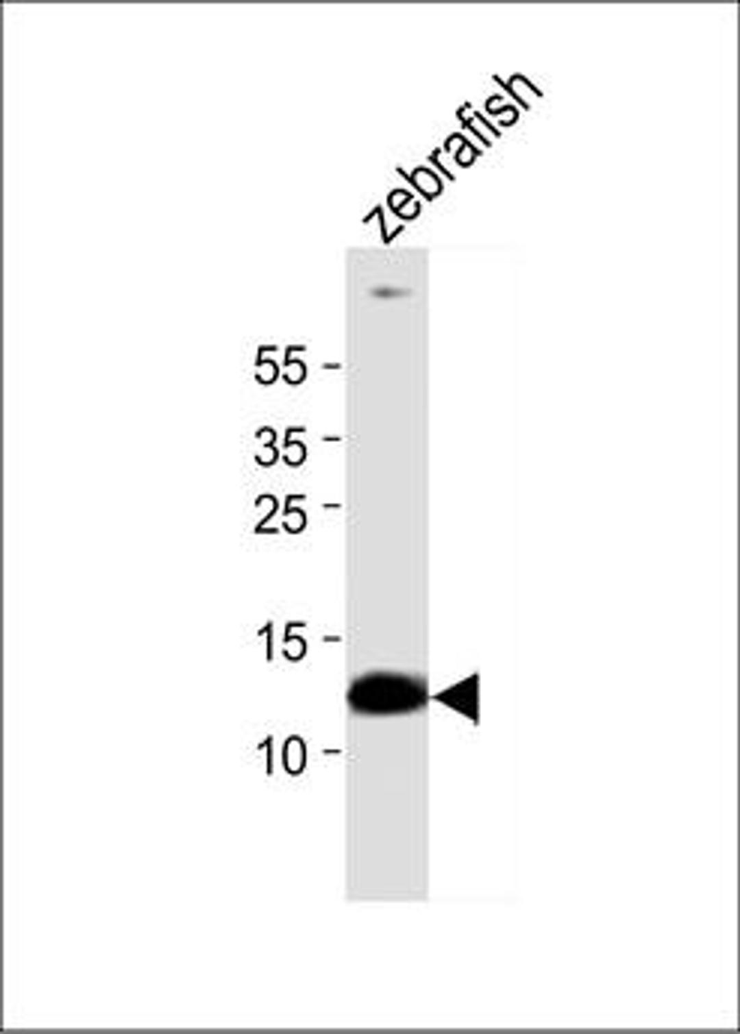 Western blot analysis of zebrafish tissueusing ba1 antibody (primary antibody dilution at: 1:1000)