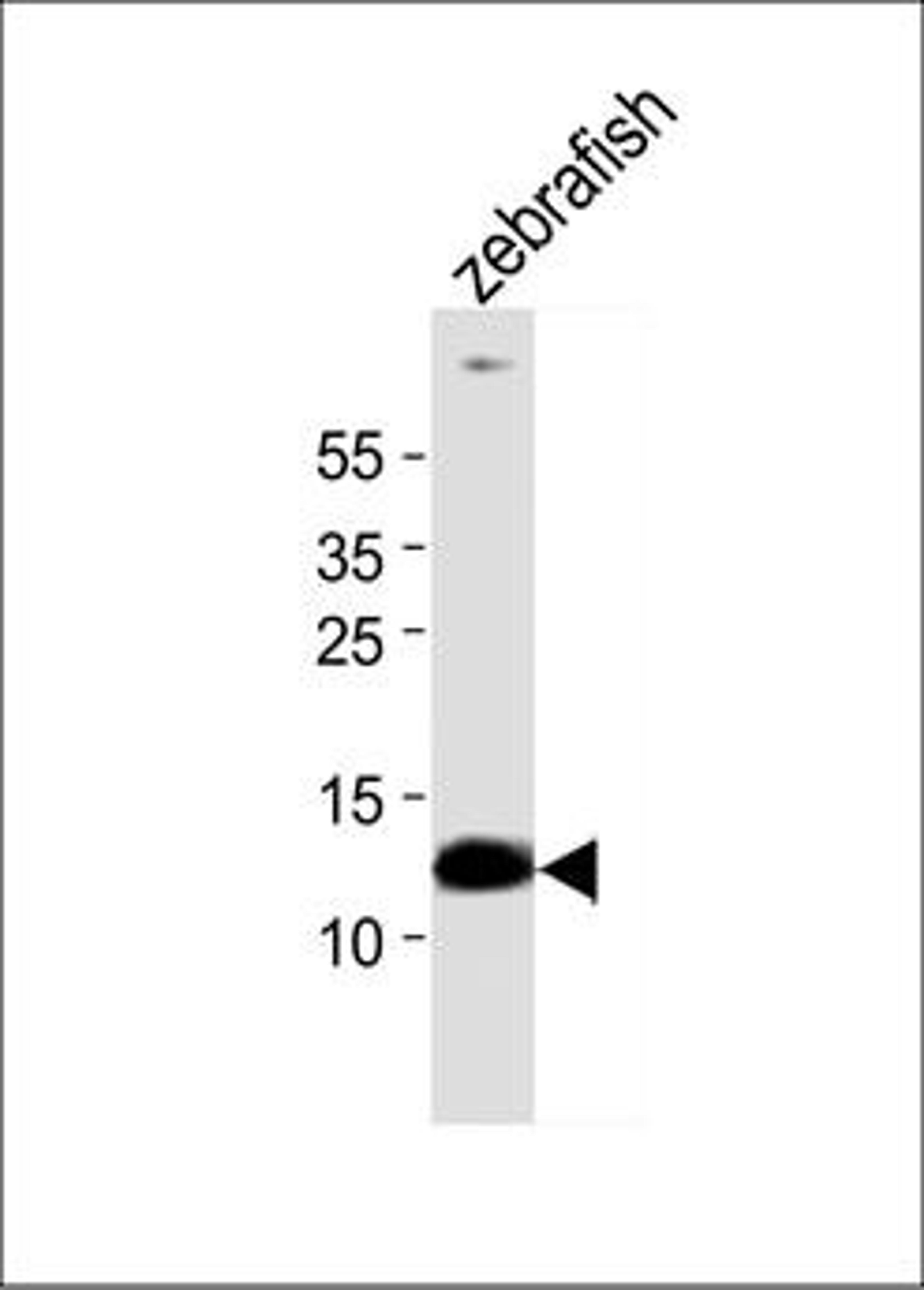 Western blot analysis of zebrafish tissueusing ba1 antibody (primary antibody dilution at: 1:1000)