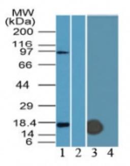 Western Blot: Fragilis Antibody [NB600-1534] - Analysis of Fragilis in mouse ES lysate in the (1) absence and (2) presence of immunizing peptide and in mouse NIH3T3 lysate in the (3) absence and (4) presence of immunizing peptide using Fragilis antibody at 1 ug/ml.