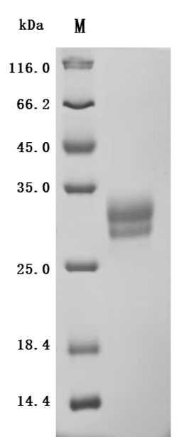 (Tris-Glycine gel) Discontinuous SDS-PAGE (reduced) with 5% enrichment gel and 15% separation gel.
