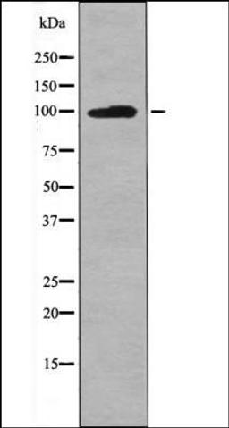 Western blot analysis of 293 whole cell lysates using Leptin Receptor -Phospho-Tyr986- antibody