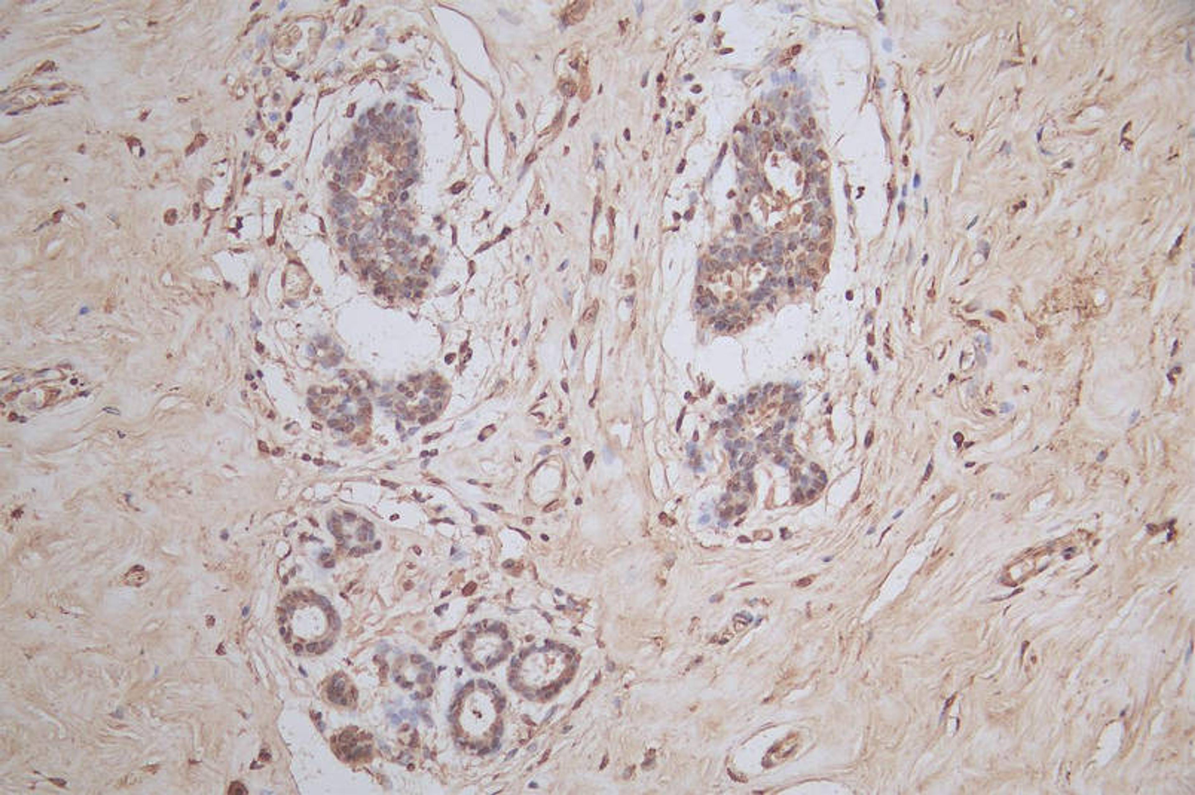 IHC image of CSB-RA022332MA1HU diluted at 1:50 and staining in paraffin-embedded human breast tissue performed on a Leica BondTM system. After dewaxing and hydration,  antigen retrieval was mediated by high pressure in a citrate buffer (pH 6.0). Section was blocked with 10% normal goat serum 30min at RT. Then primary antibody (1% BSA) was incubated at 4°C overnight. The primary is detected by a Goat anti-mouse polymer IgG labeled by HRP and visualized using 0.05% DAB.