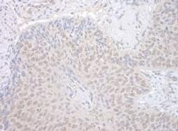 Detection of human NEK7 by immunohistochemistry.