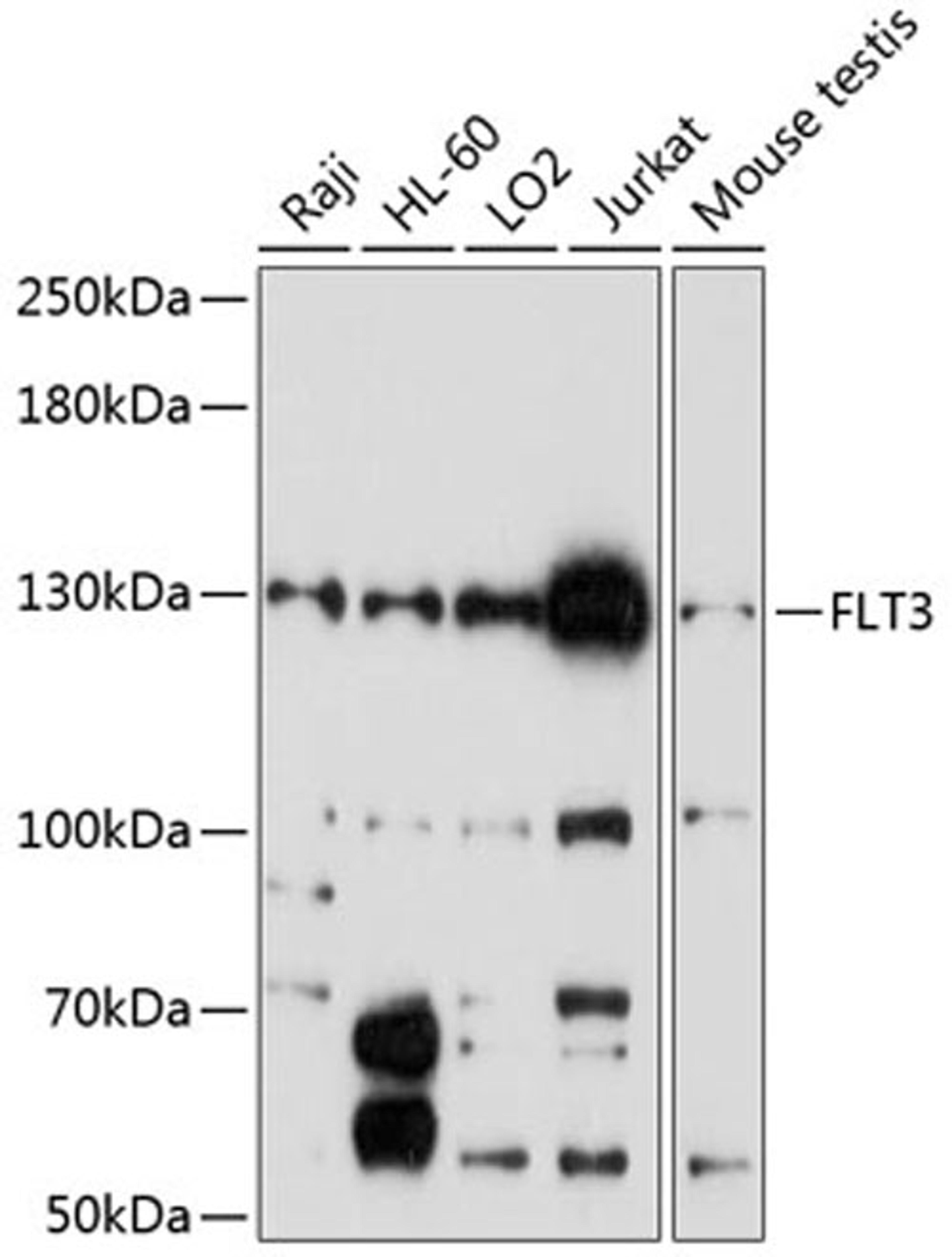 Western blot - FLT3 antibody (A12437)