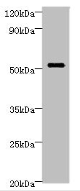 Western blot. All lanes: STARD3 Antibody at 6ug/ml + MCF-7 whole cell lysate. Secondary. Goat polyclonal to rabbit IgG at 1/10000 dilution. Predicted band size: 51, 49, 50 kDa. Observed band size: 51 kDa.