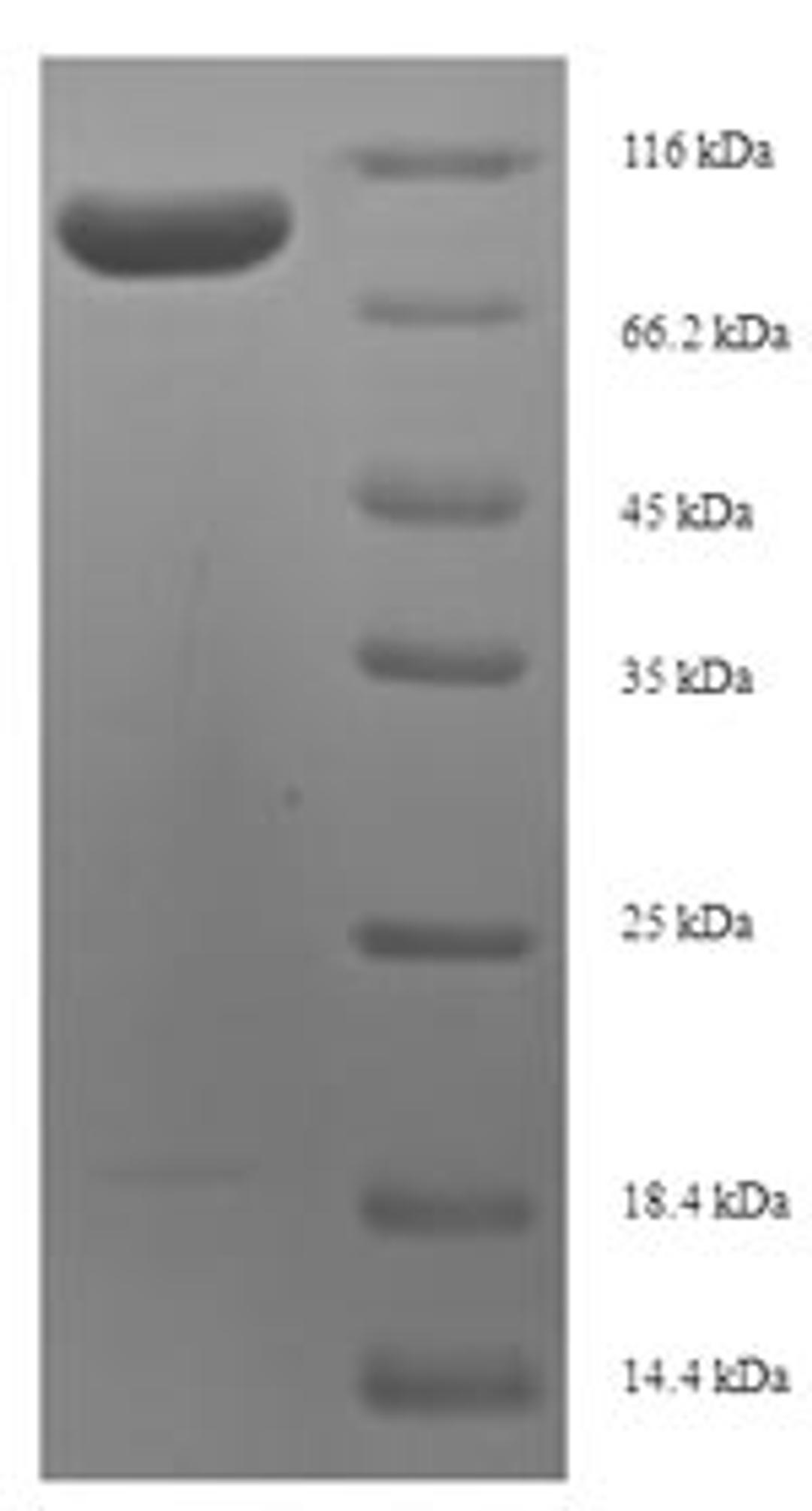 (Tris-Glycine gel) Discontinuous SDS-PAGE (reduced) with 5% enrichment gel and 15% separation gel.