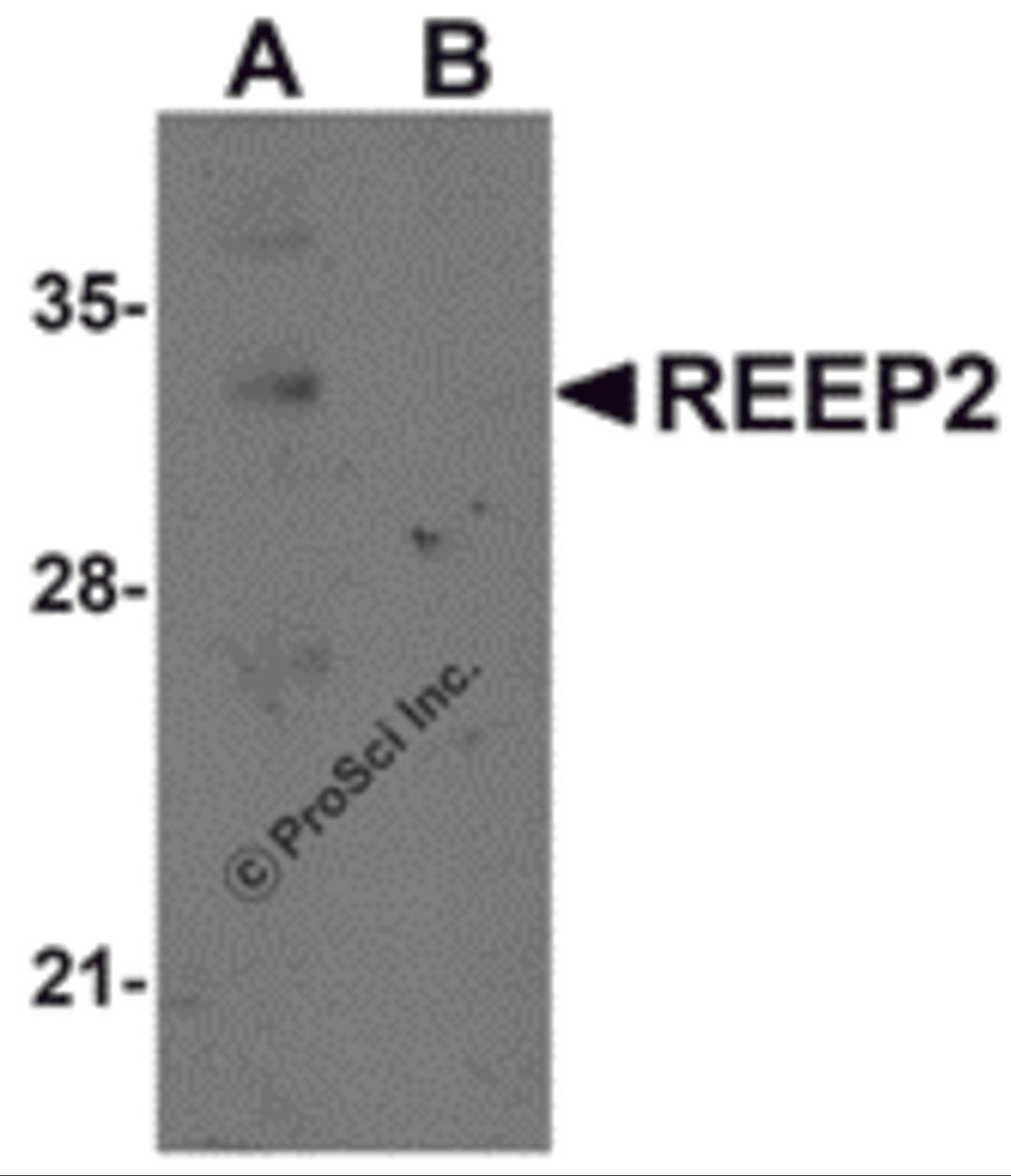 Western blot analysis of REEP2 in mouse lung tissue lysate with REEP2 antibody at 1 μg/mL in (A) the absence and (B) the presence of blocking peptide.