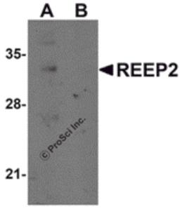 Western blot analysis of REEP2 in mouse lung tissue lysate with REEP2 antibody at 1 μg/mL in (A) the absence and (B) the presence of blocking peptide.