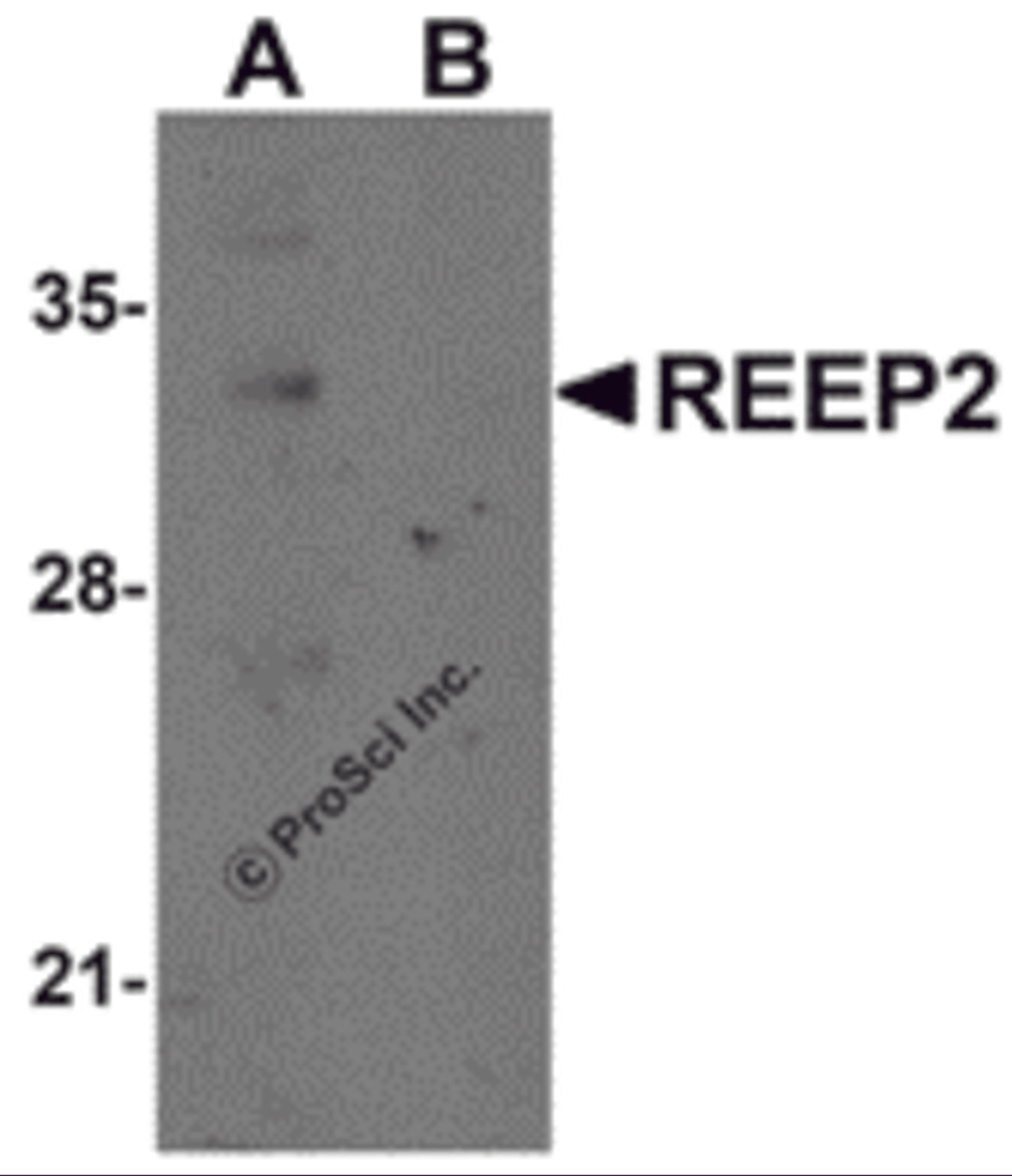 Western blot analysis of REEP2 in mouse lung tissue lysate with REEP2 antibody at 1 μg/mL in (A) the absence and (B) the presence of blocking peptide.