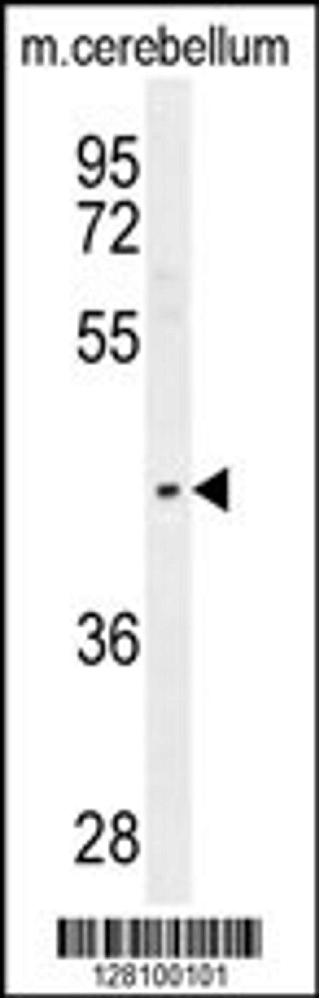 Western blot analysis in mouse cerebellum tissue lysates (35ug/lane).