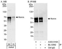 Detection of human Ikaros by western blot and immunoprecipitation.