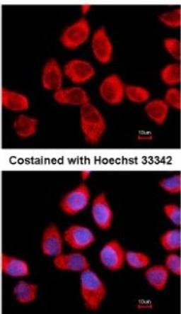 Immunocytochemistry/Immunofluorescence: RPLP2 Antibody [NBP2-15104] - Analysis of methanol-fixed A431, using antibody at 1:500 dilution.