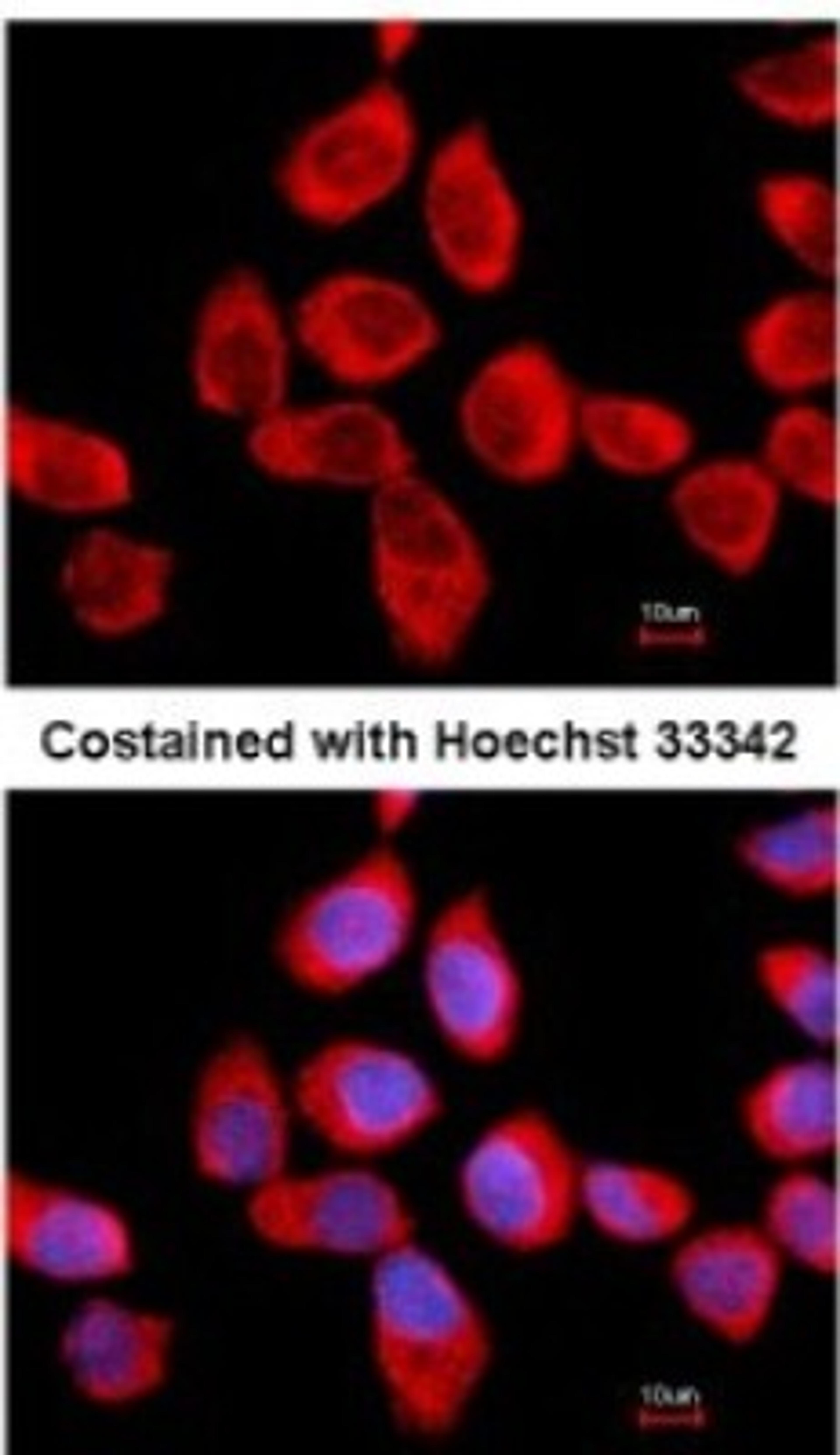 Immunocytochemistry/Immunofluorescence: RPLP2 Antibody [NBP2-15104] - Analysis of methanol-fixed A431, using antibody at 1:500 dilution.