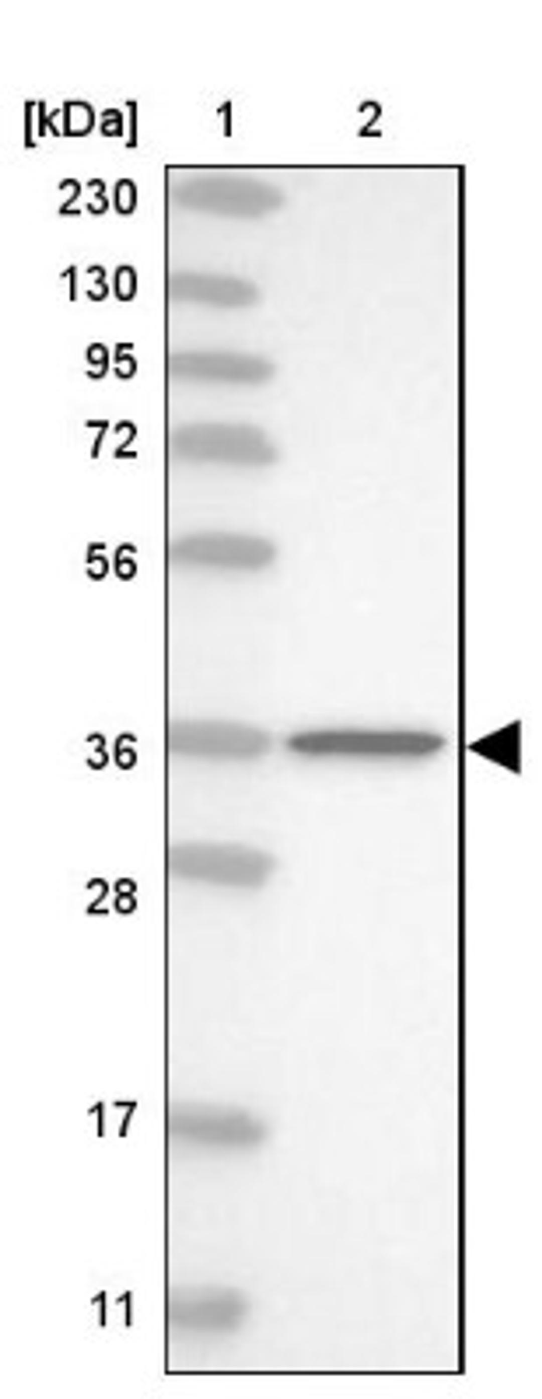 Western Blot: NPL Antibody [NBP1-88482] - Lane 1: Marker [kDa] 230, 130, 95, 72, 56, 36, 28, 17, 11<br/>Lane 2: Human cell line RT-4