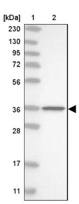 Western Blot: NPL Antibody [NBP1-88482] - Lane 1: Marker [kDa] 230, 130, 95, 72, 56, 36, 28, 17, 11<br/>Lane 2: Human cell line RT-4