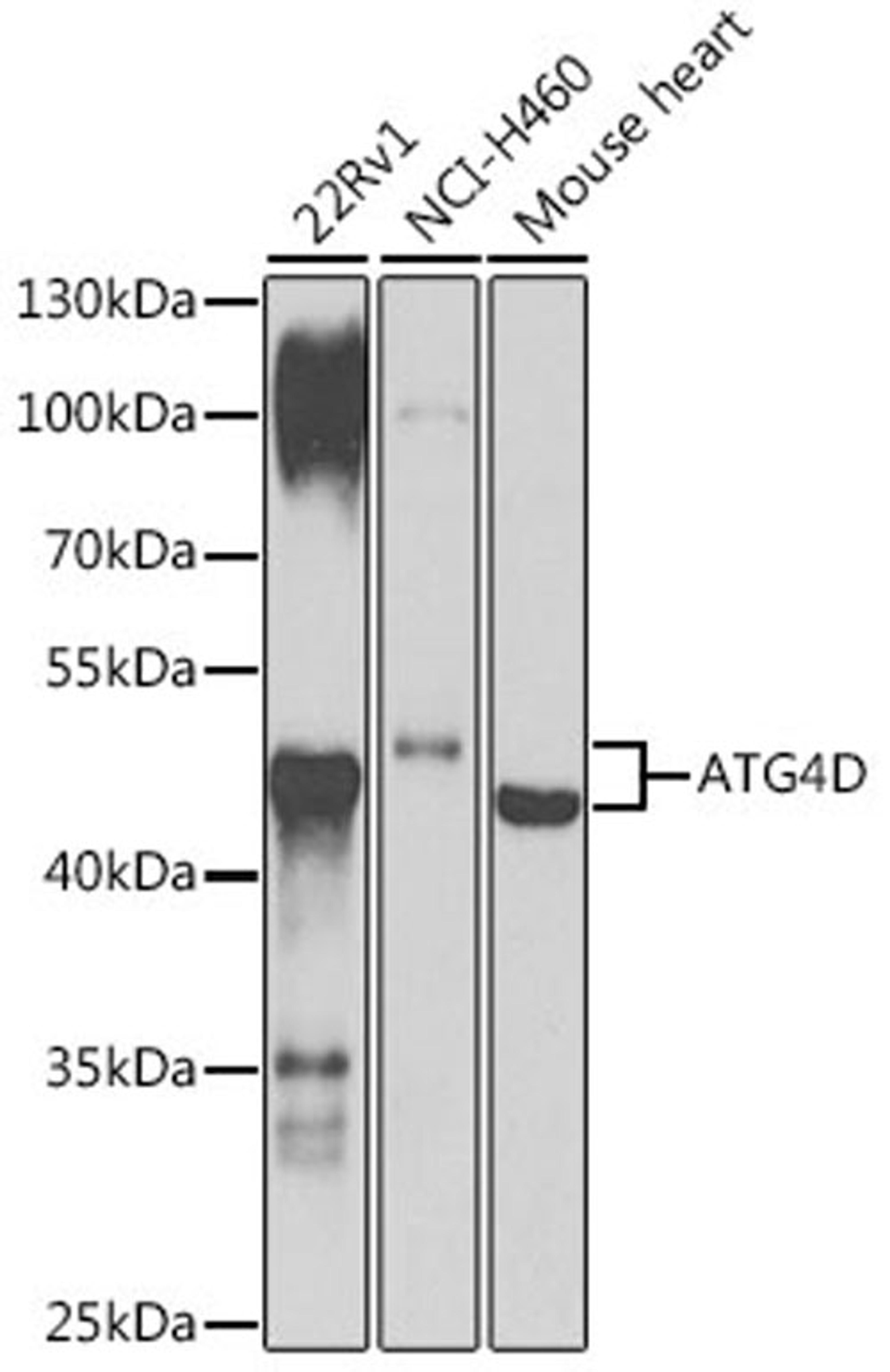 Western blot - ATG4D antibody (A7842)