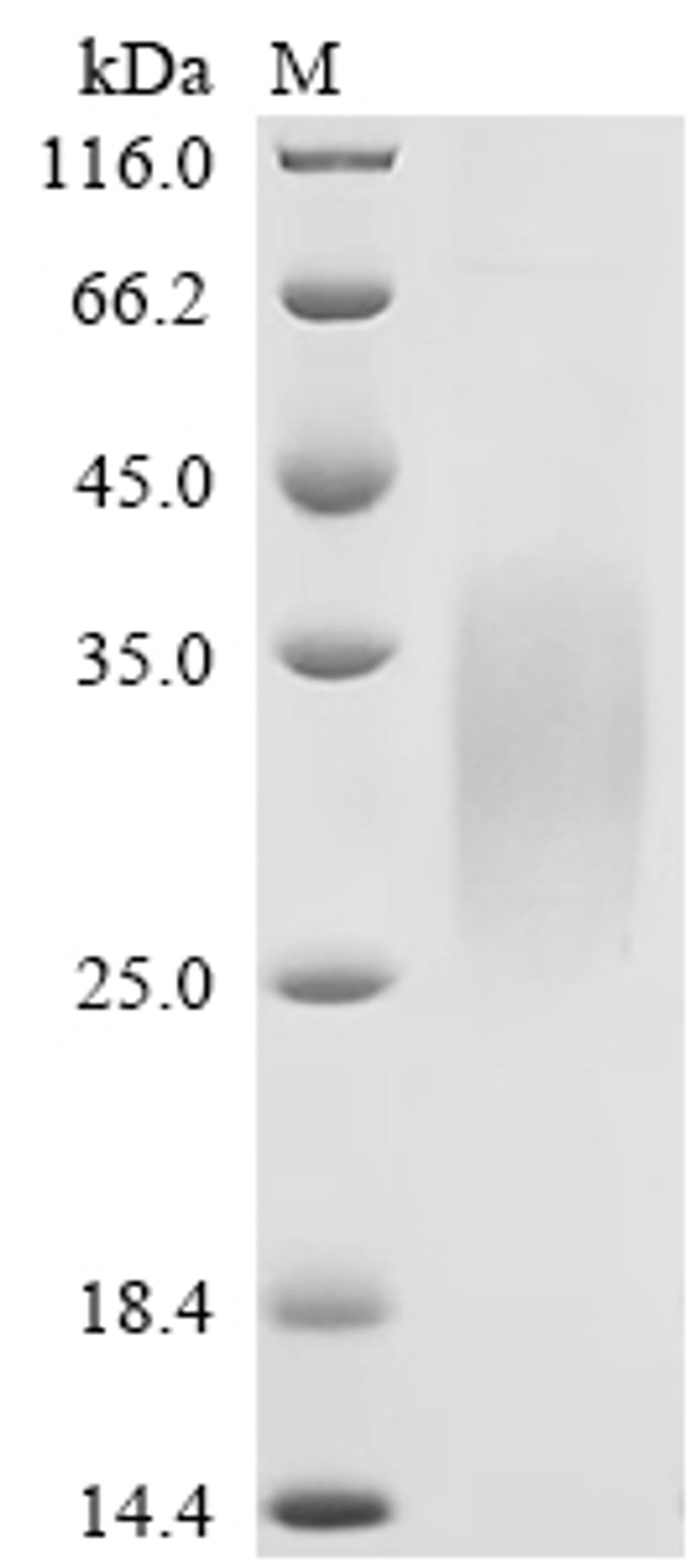 (Tris-Glycine gel) Discontinuous SDS-PAGE (reduced) with 5% enrichment gel and 15% separation gel.