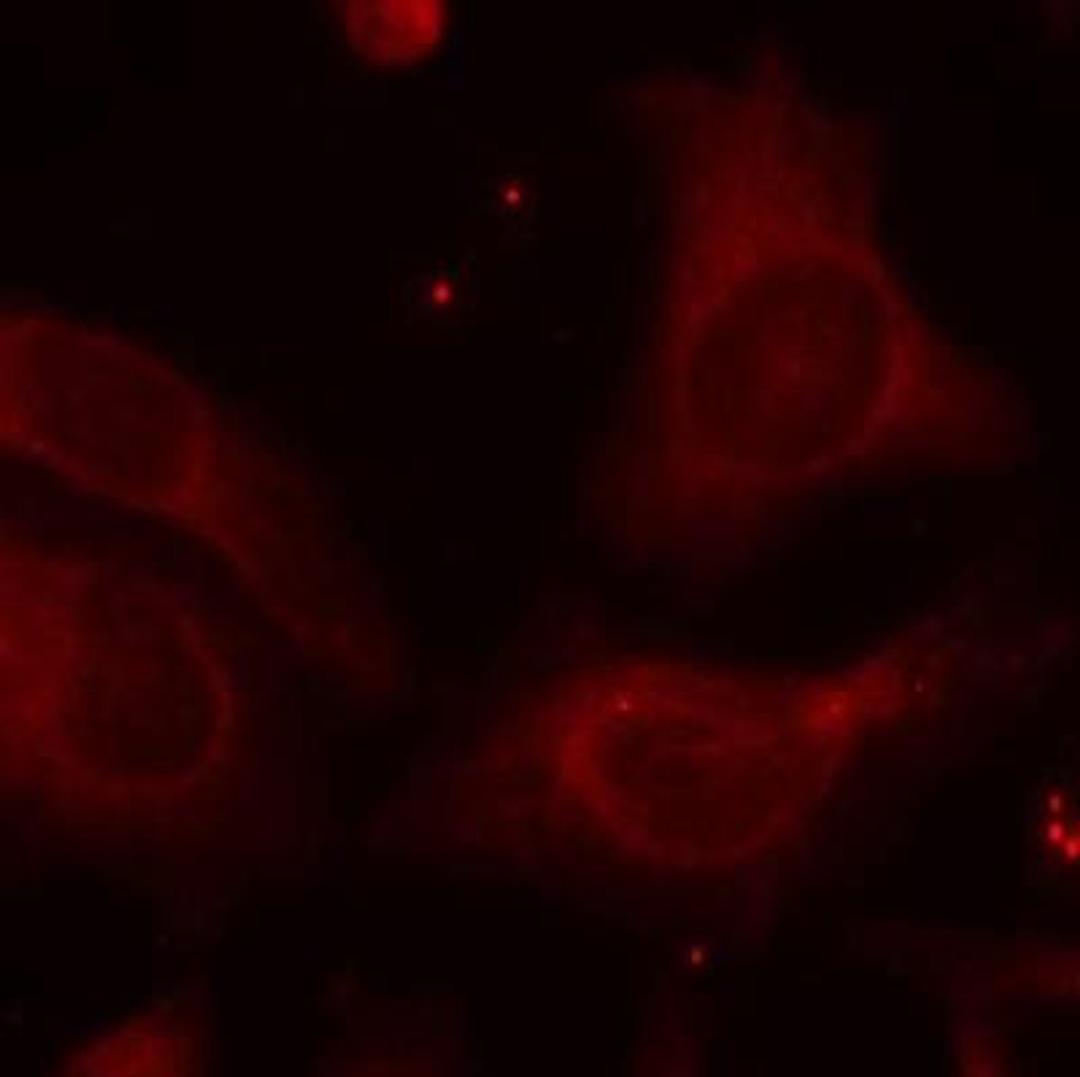 Immunocytochemistry/Immunofluorescence: NFkB p105/p50 [p Ser927] Antibody [NB100-82069] - Staining of methanol-fixed Hela cells using NFkB-p105(Phospho-Ser927) Antibody.