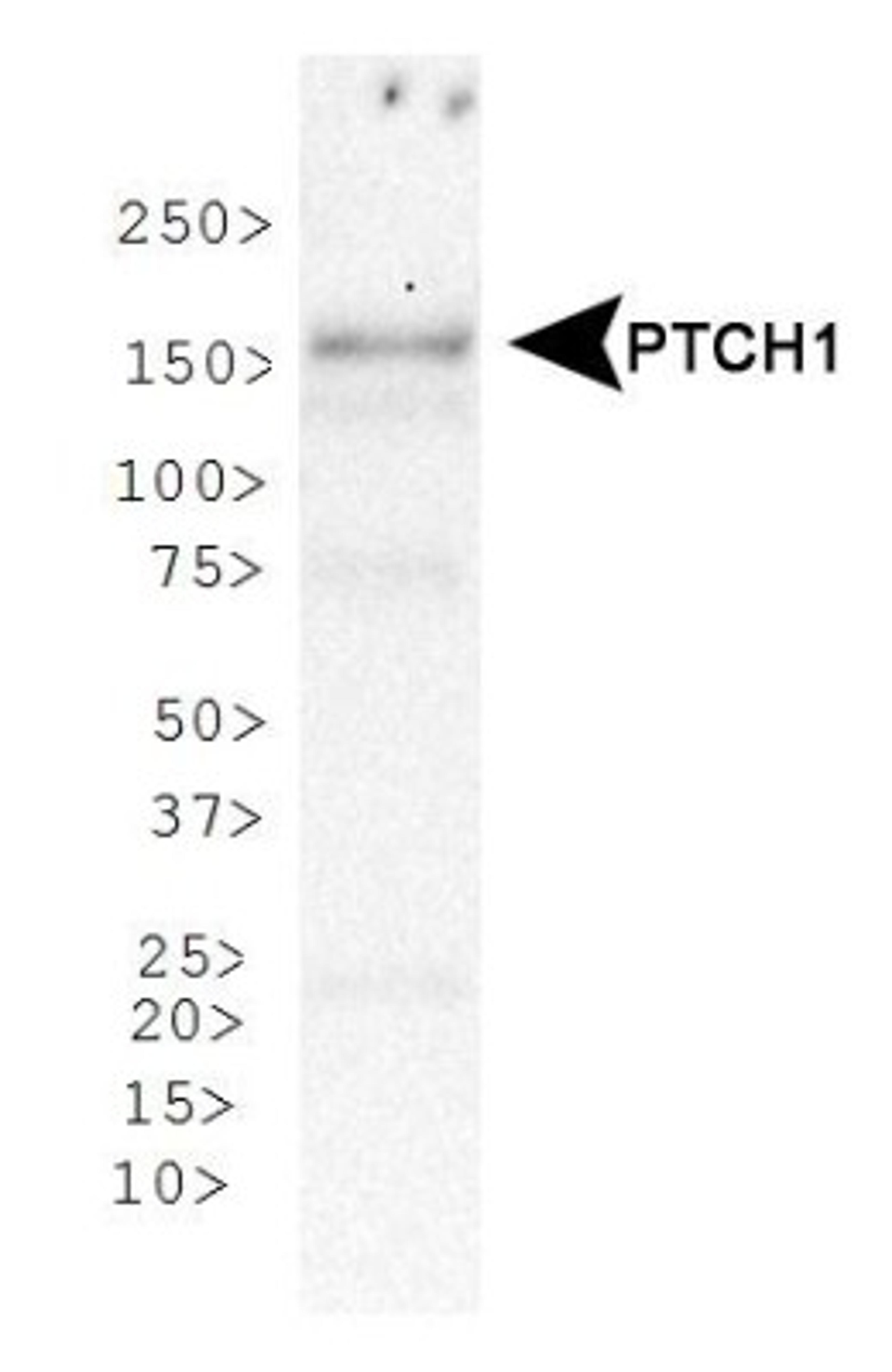 Western Blot: Patched 1 Antibody [NBP1-71662] - Analysis of Patched 1 in human skeletal muscle protein.