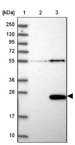 Western Blot: bcl10-interacting CARD protein Antibody [NBP2-38125] - Lane 1: Marker [kDa] 250, 130, 95, 72, 55, 36, 28, 17, 10<br/>Lane 2: Negative Control<br/>Lane 3: LY410210