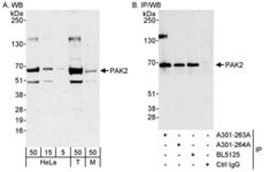 Detection of human and mouse PAK2 by western blot (h&m) and immunoprecipitation (h).