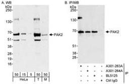 Detection of human and mouse PAK2 by western blot (h&m) and immunoprecipitation (h).