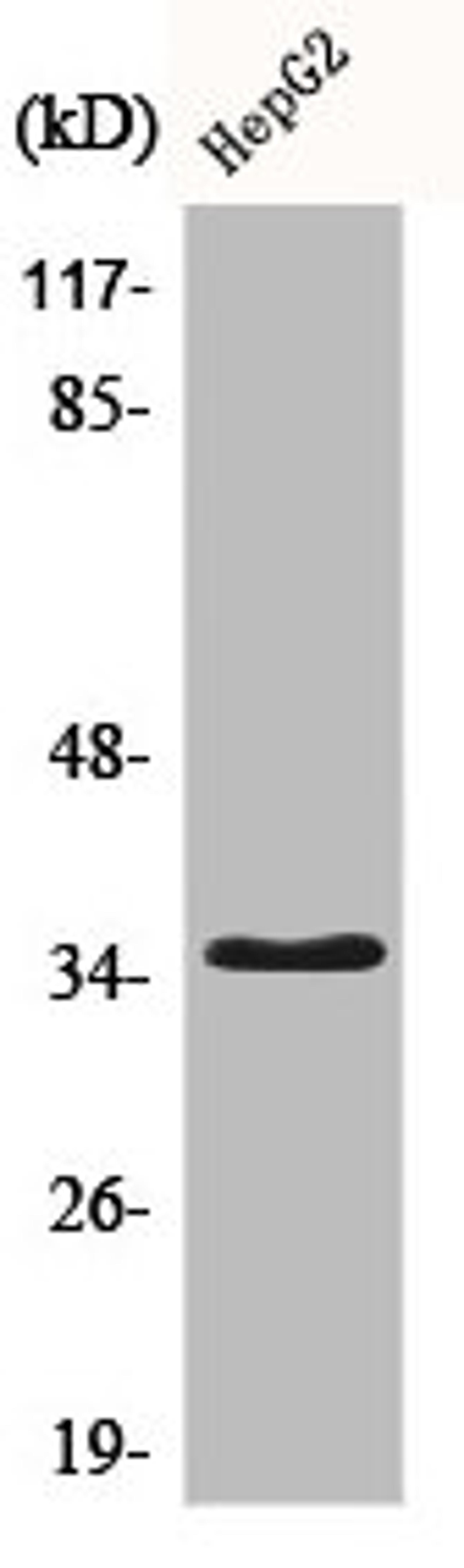 Western Blot analysis of HepG2 cells using CD34 Polyclonal Antibody