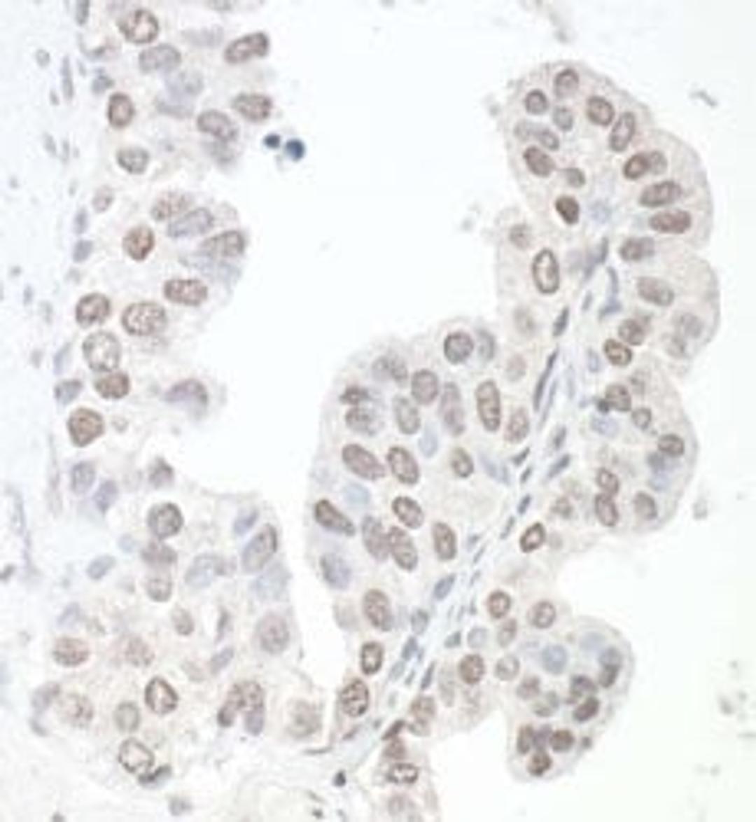 Detection of human SMC6 by immunohistochemistry.