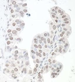 Detection of human SMC6 by immunohistochemistry.