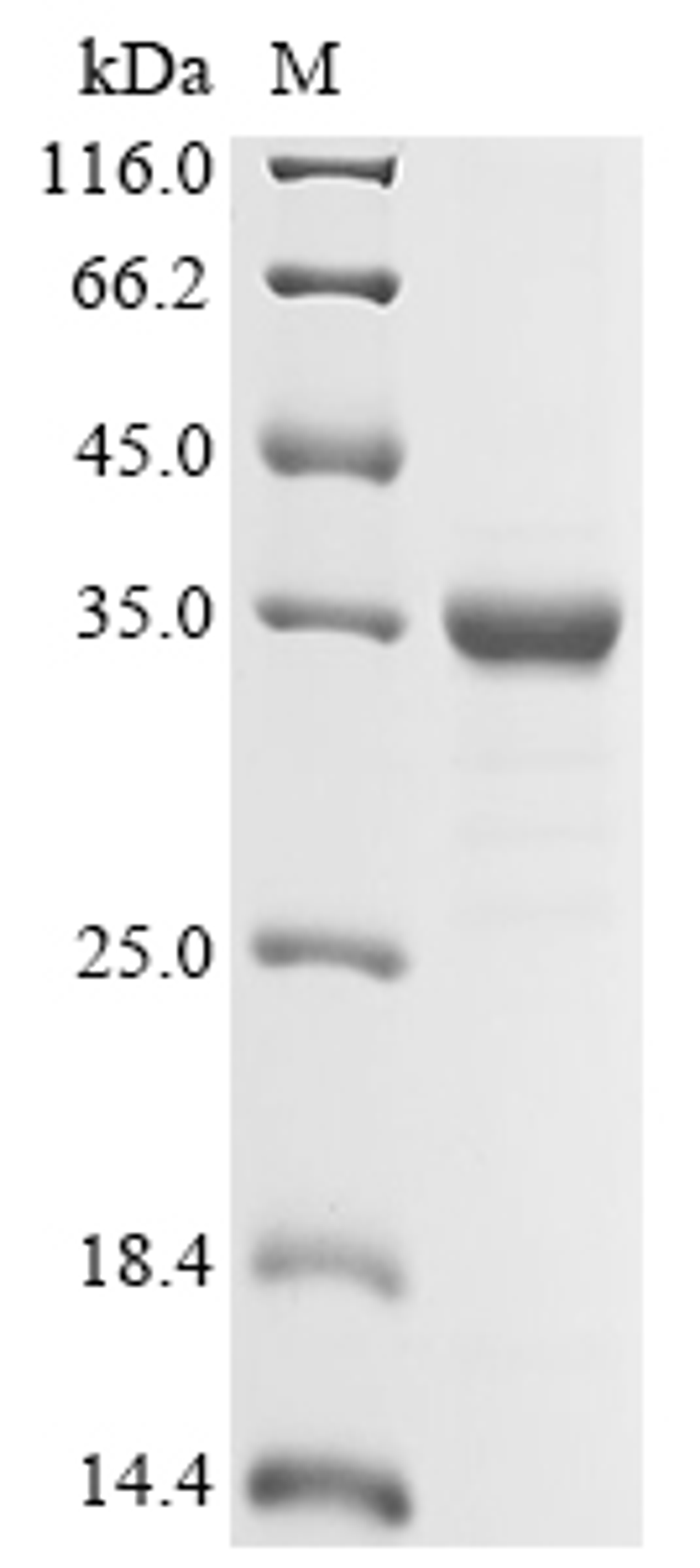 (Tris-Glycine gel) Discontinuous SDS-PAGE (reduced) with 5% enrichment gel and 15% separation gel.