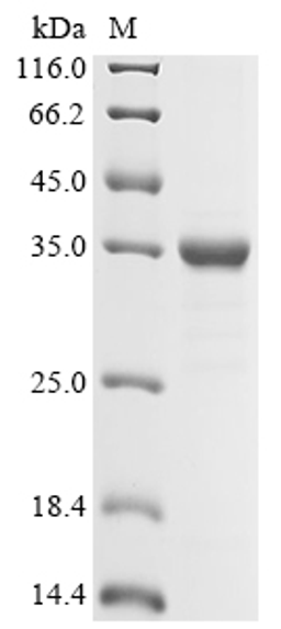 (Tris-Glycine gel) Discontinuous SDS-PAGE (reduced) with 5% enrichment gel and 15% separation gel.