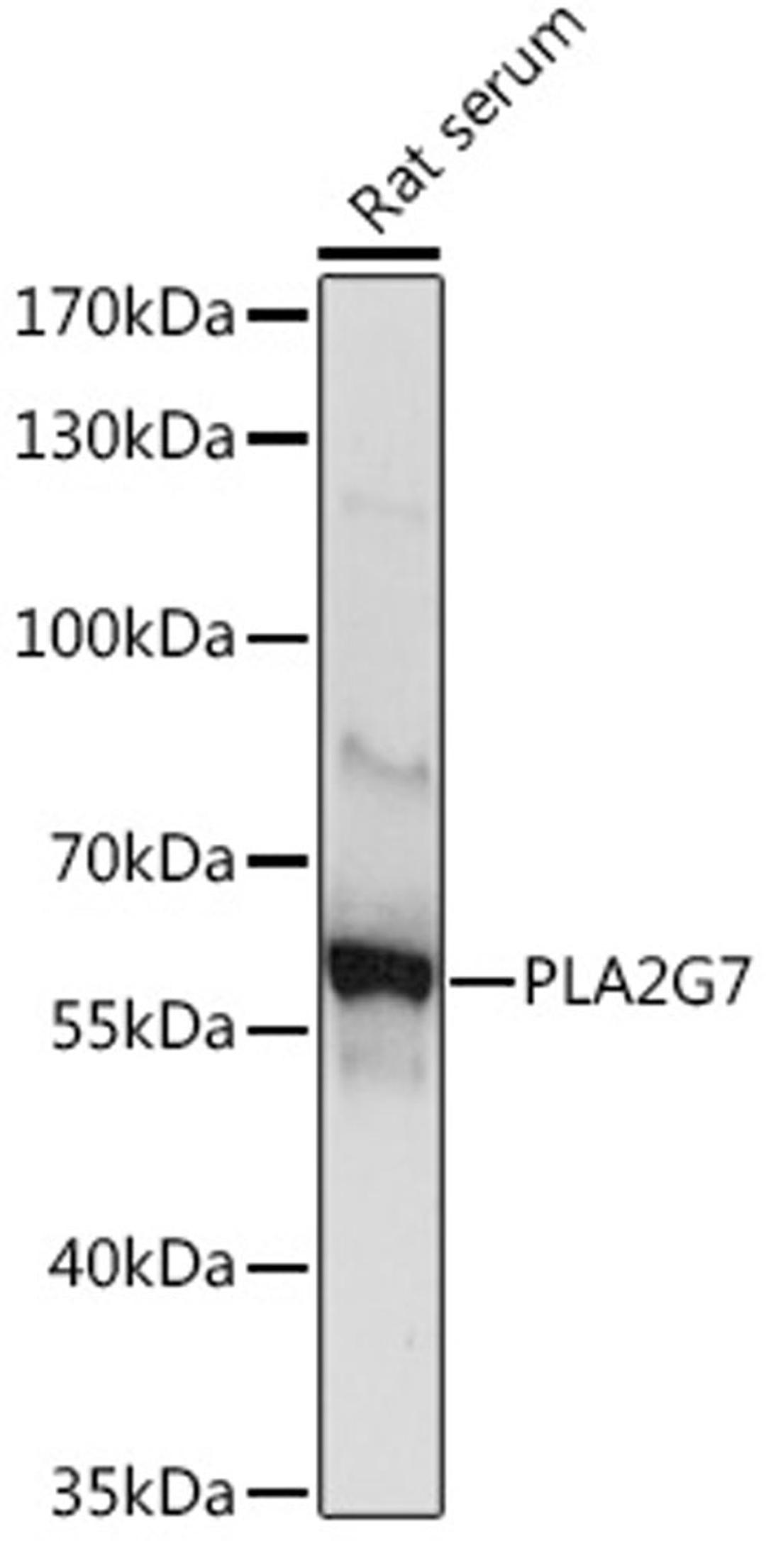 Western blot - PLA2G7 Rabbit pAb (A9796)